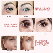 Load image into Gallery viewer, NEW 5 in 1 EMS Beauty Instrument RF RadioFrequency Facial LED Photon Skin Care Tool Device Face Lift Massage Tighten Beauty Machine